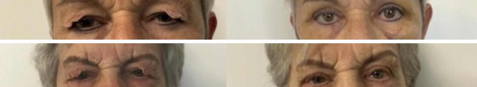 Header afbeelding